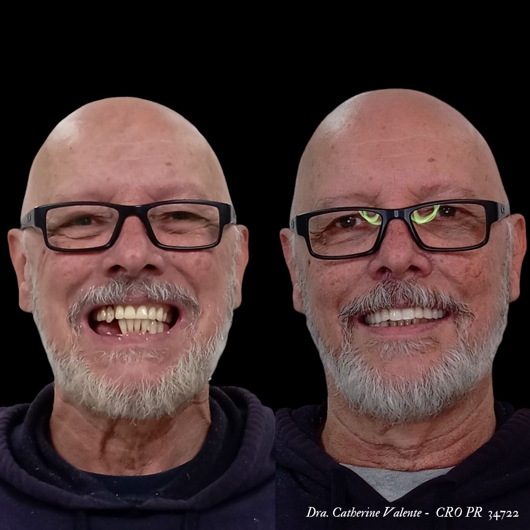 Catherine Ariadne De França  Valente-8