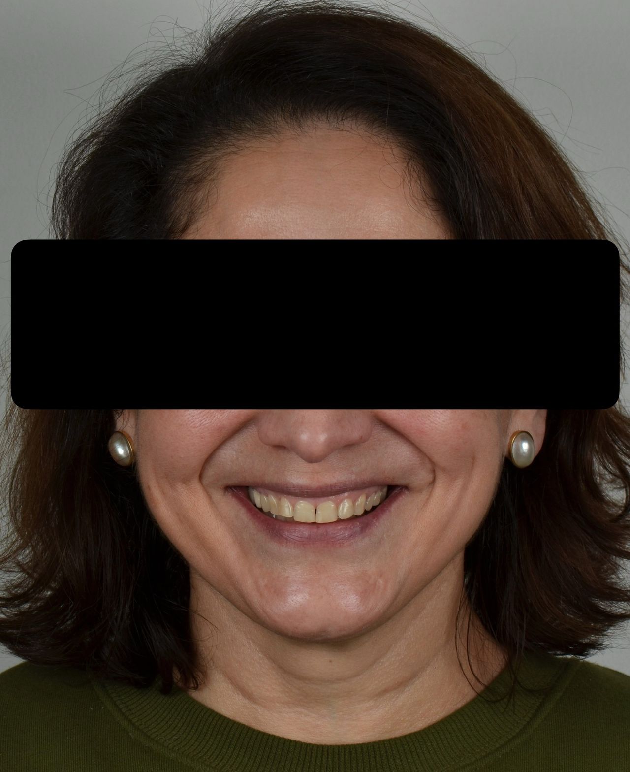 Luciano Varas Salinas-30