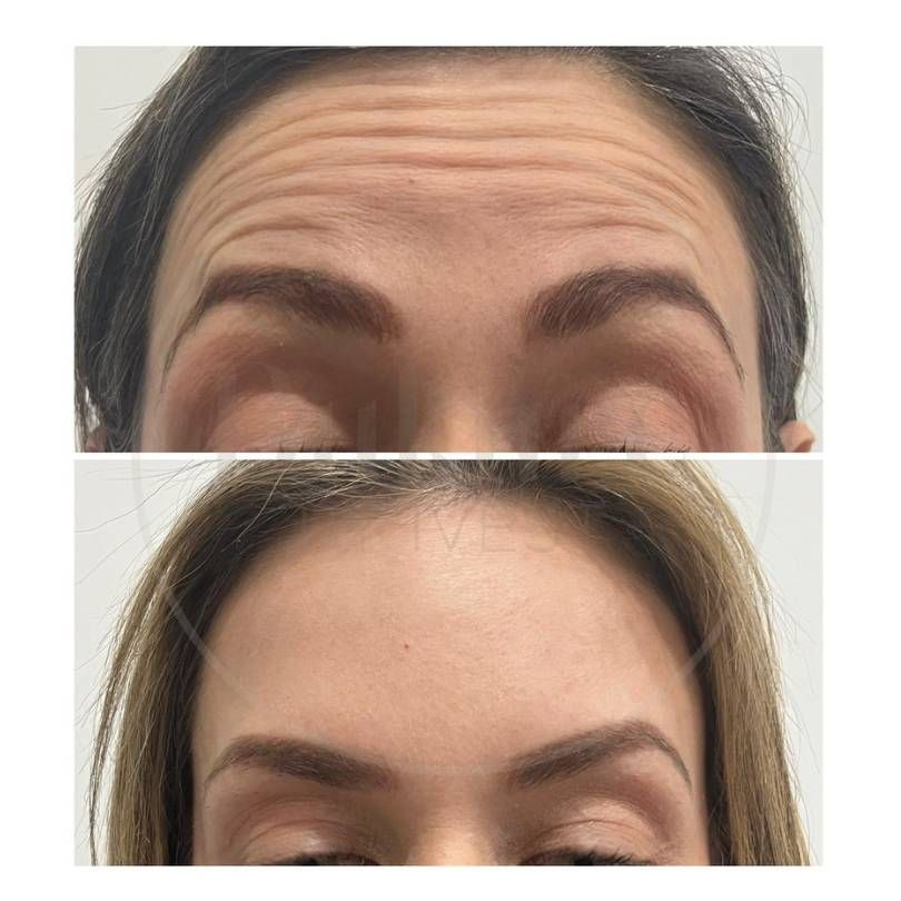 Oscar Iván Lozano Navarrete-21