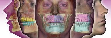 Denis Pimenta E Souza-29