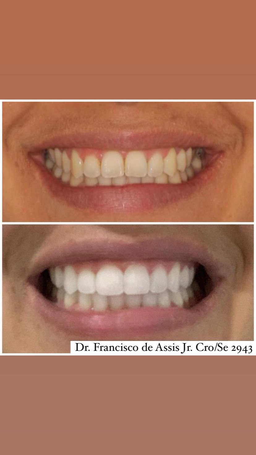 Francisco De Assis Almeida Lima Júnior-20