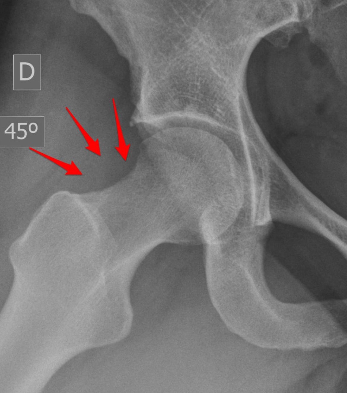 Marcus Vinicius Crestani-1