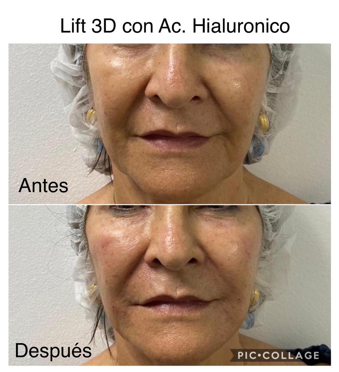 Maria Gisela Angel Losada-52