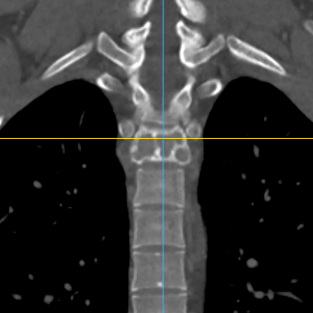 David Tafur Muñoz-2486