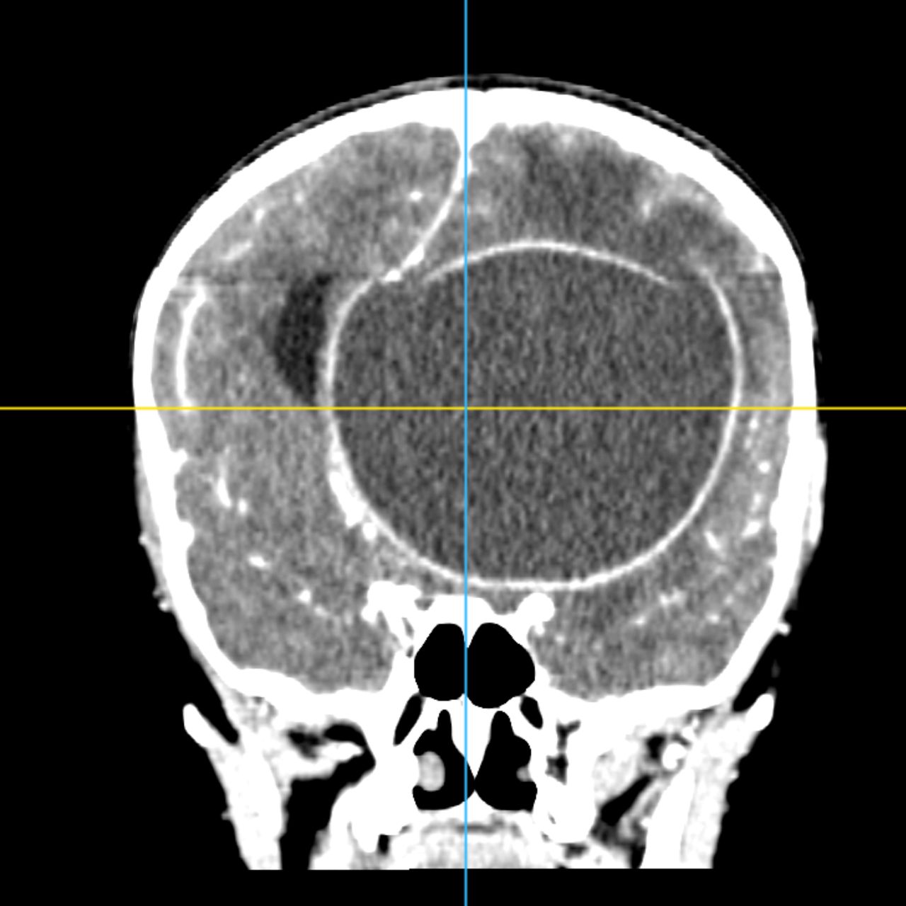David Tafur Muñoz-1999