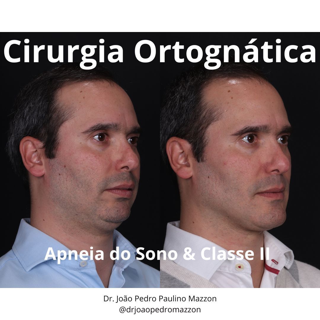 João Pedro Paulino Mazzon-46