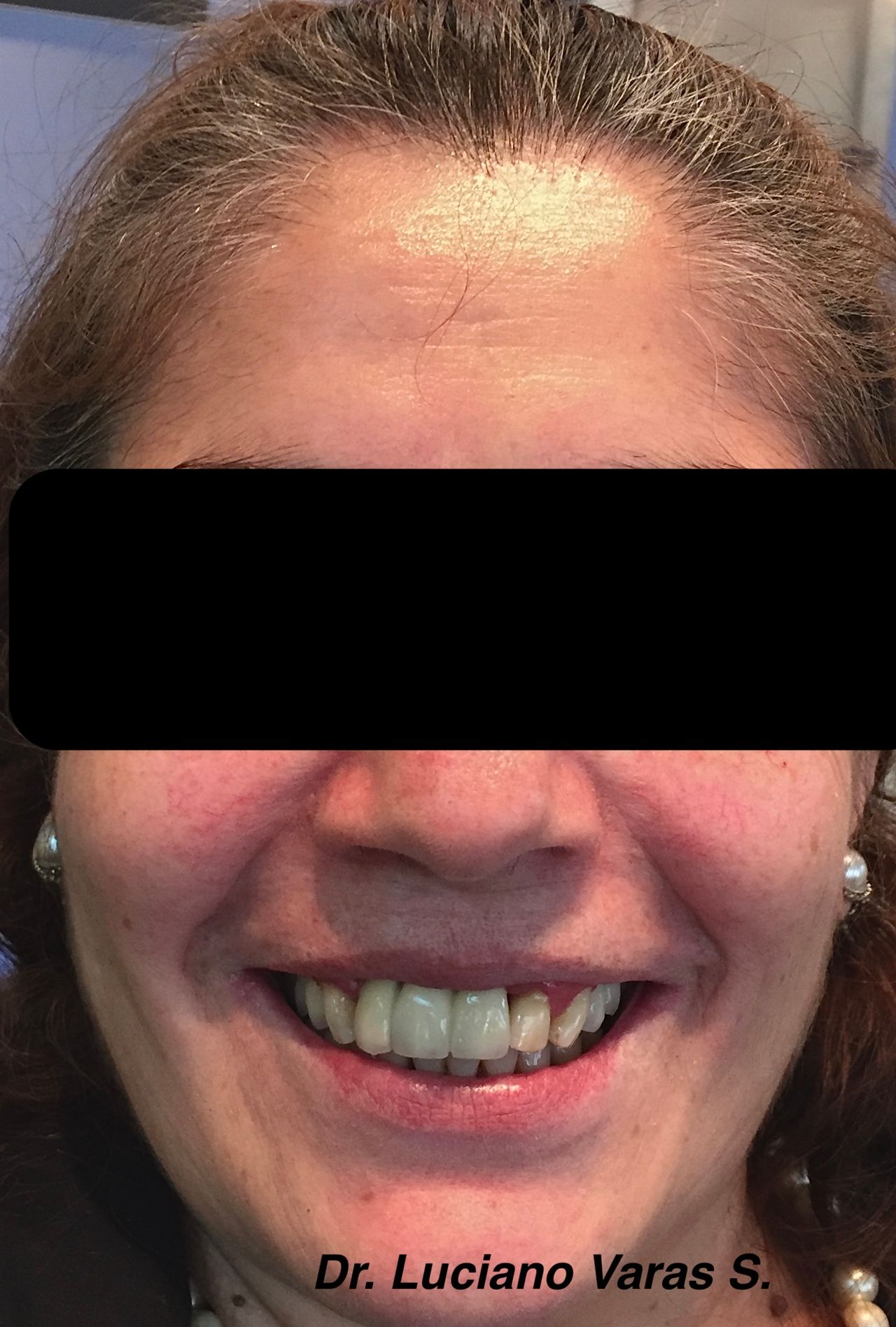 Luciano Varas Salinas-8