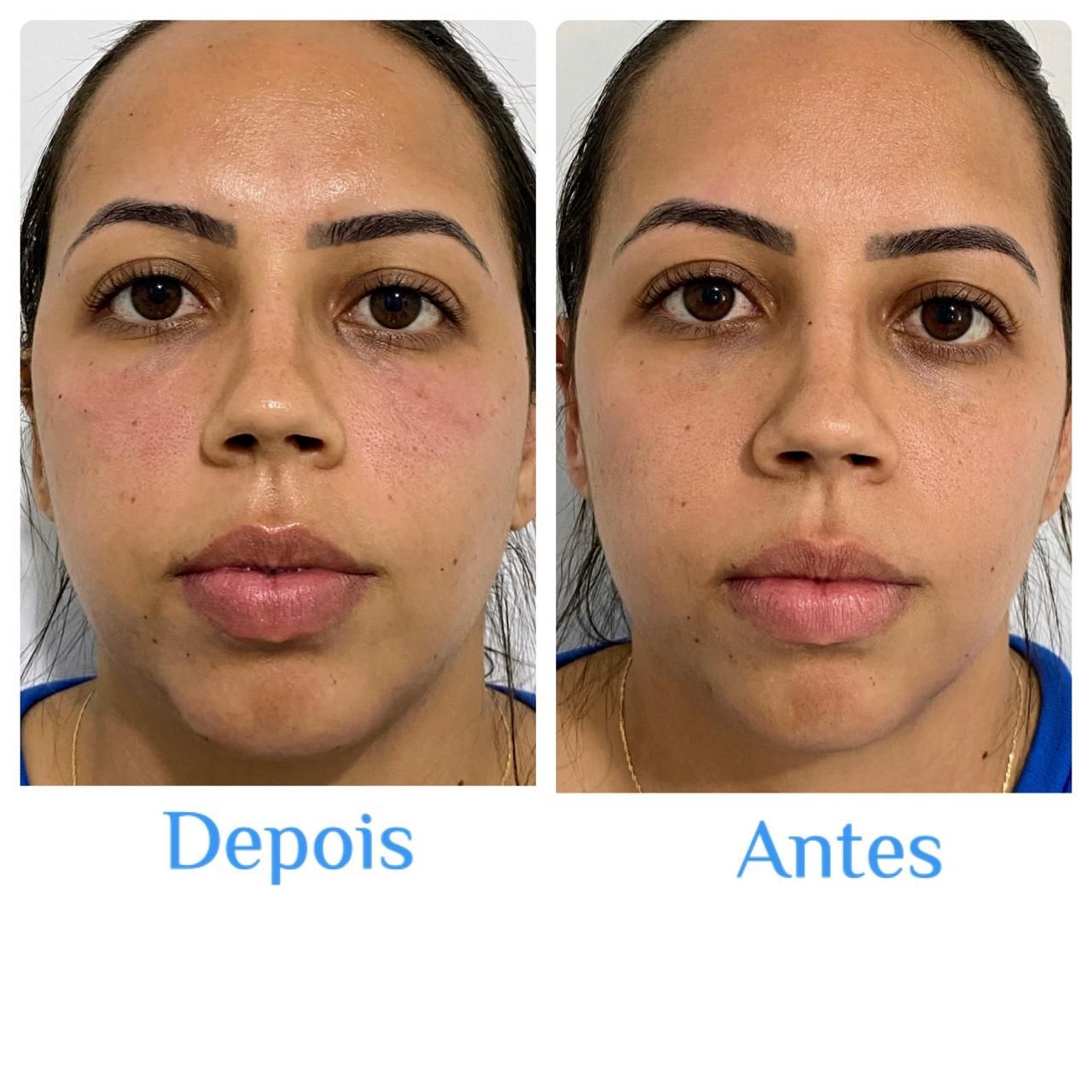 Luiz Antonio Da Silva-7