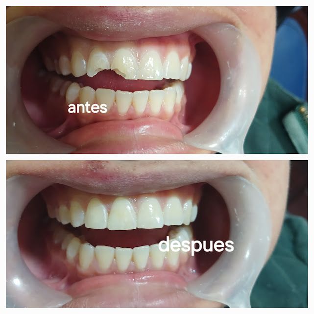 Rodolfo Nelson Olivo Gutierrez-10