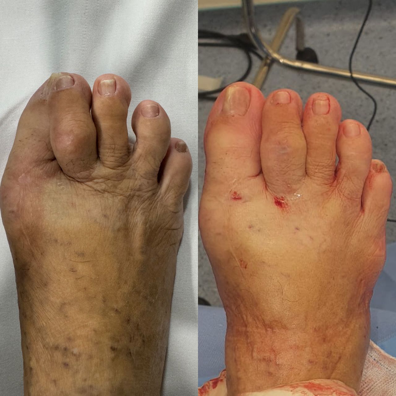 Leandro Jacomassi Machado-5