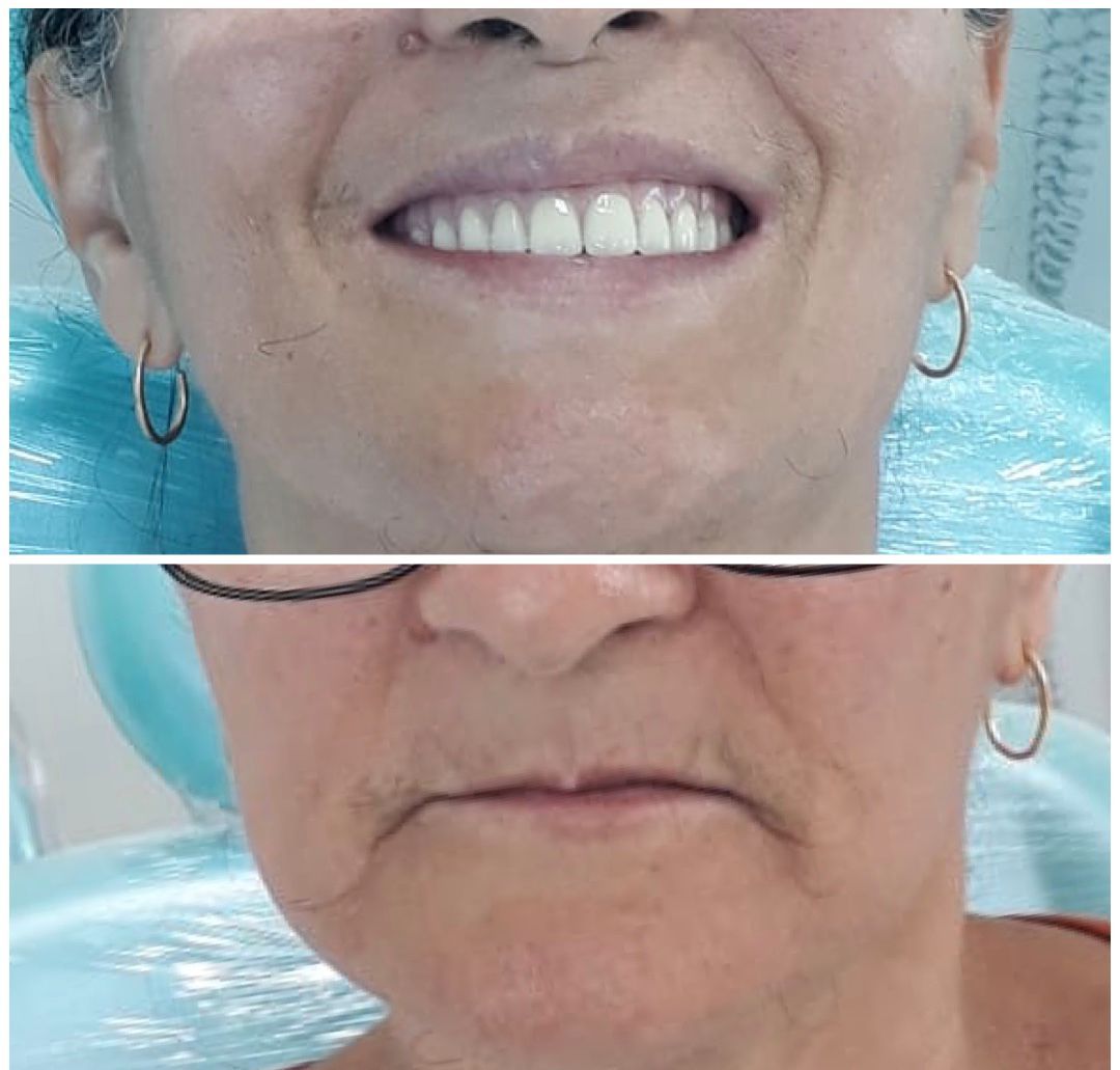 Francisco De Assis Almeida Lima Júnior-15