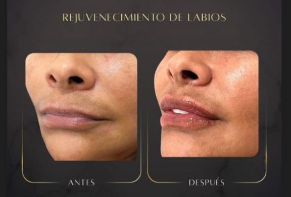 Eunice Hernández Ramos-10