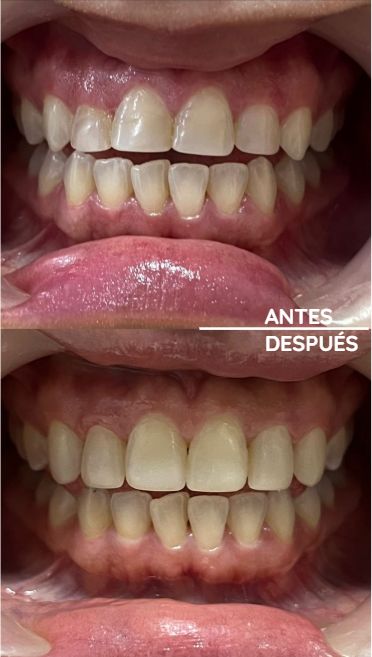 Juliana Gallego Quintero-15