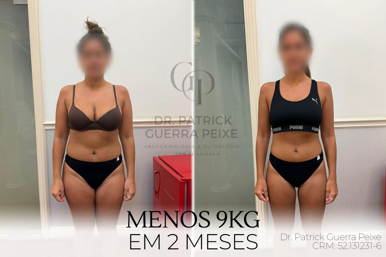 Patrick Guerra Peixe-3