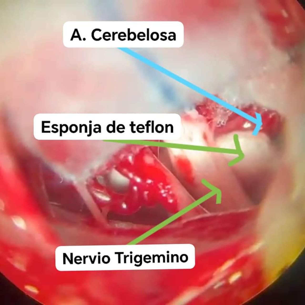 David Tafur Muñoz-1307