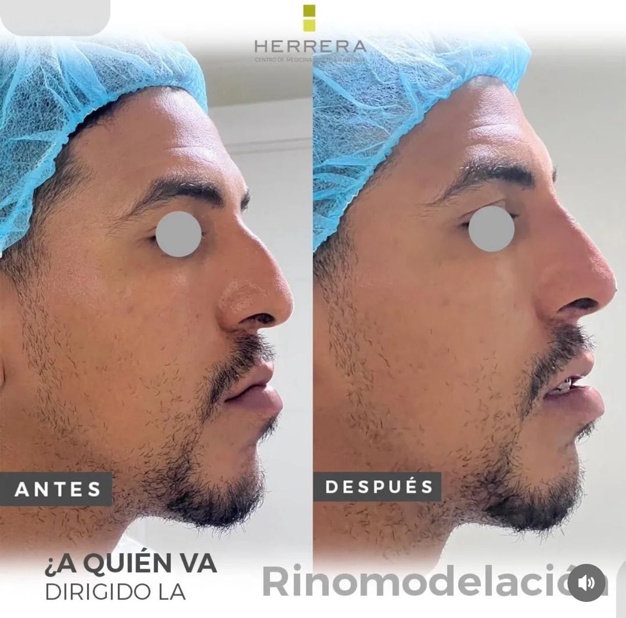 Andrea Alonso Herrera-13