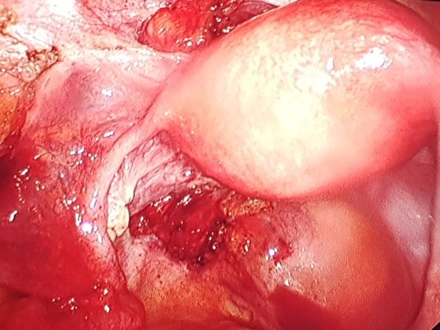 Gislayne Nunes De Souza-6