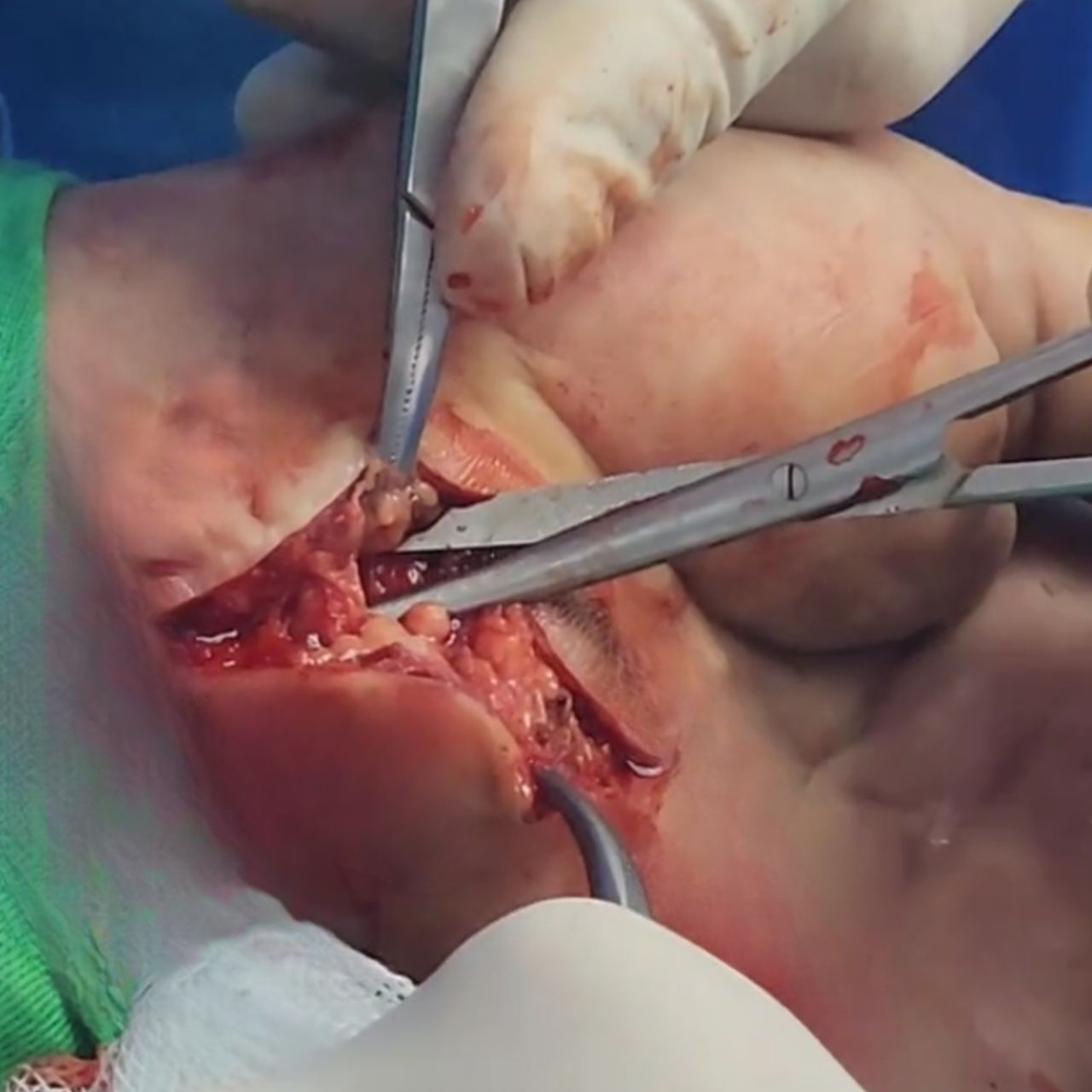 David Tafur Muñoz-1230