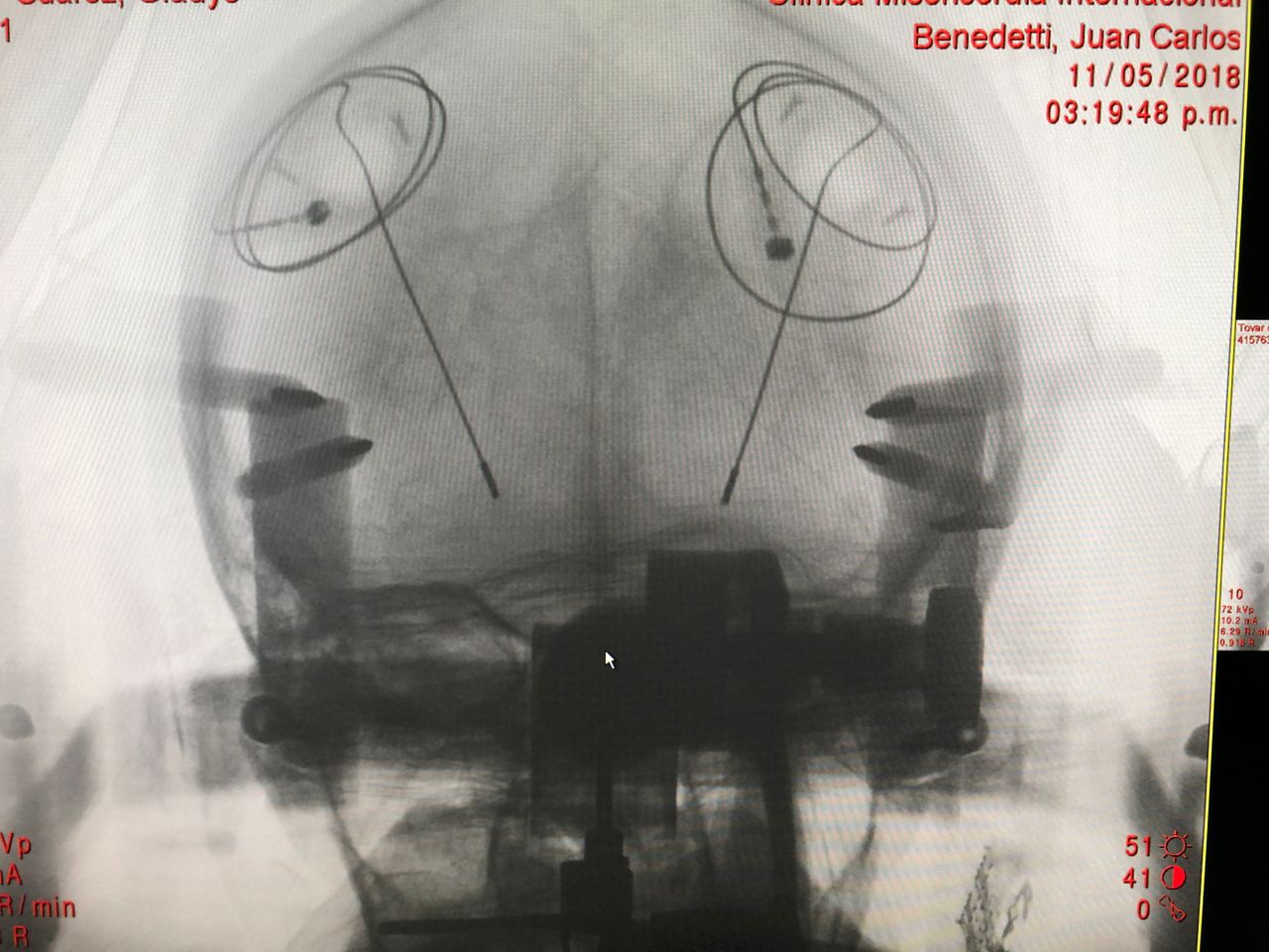 Juan Carlos Benedetti Isaac-7