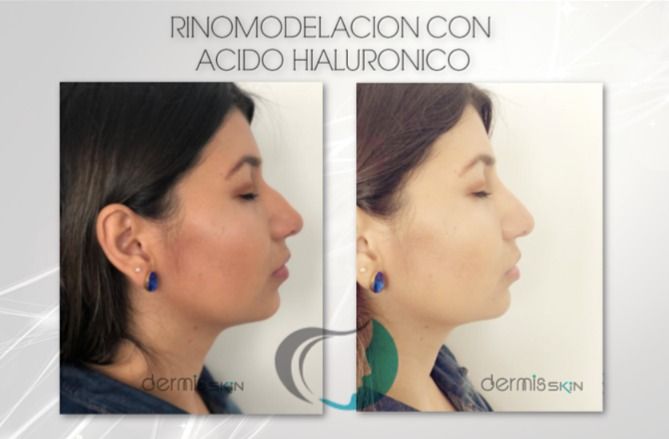 Carlos Alberto Ceron Gomez-10