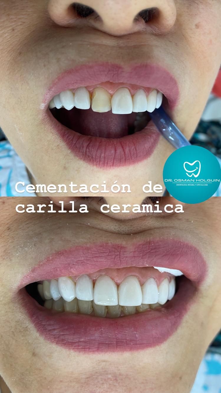 Osman Fernando Holguin Grisales-3