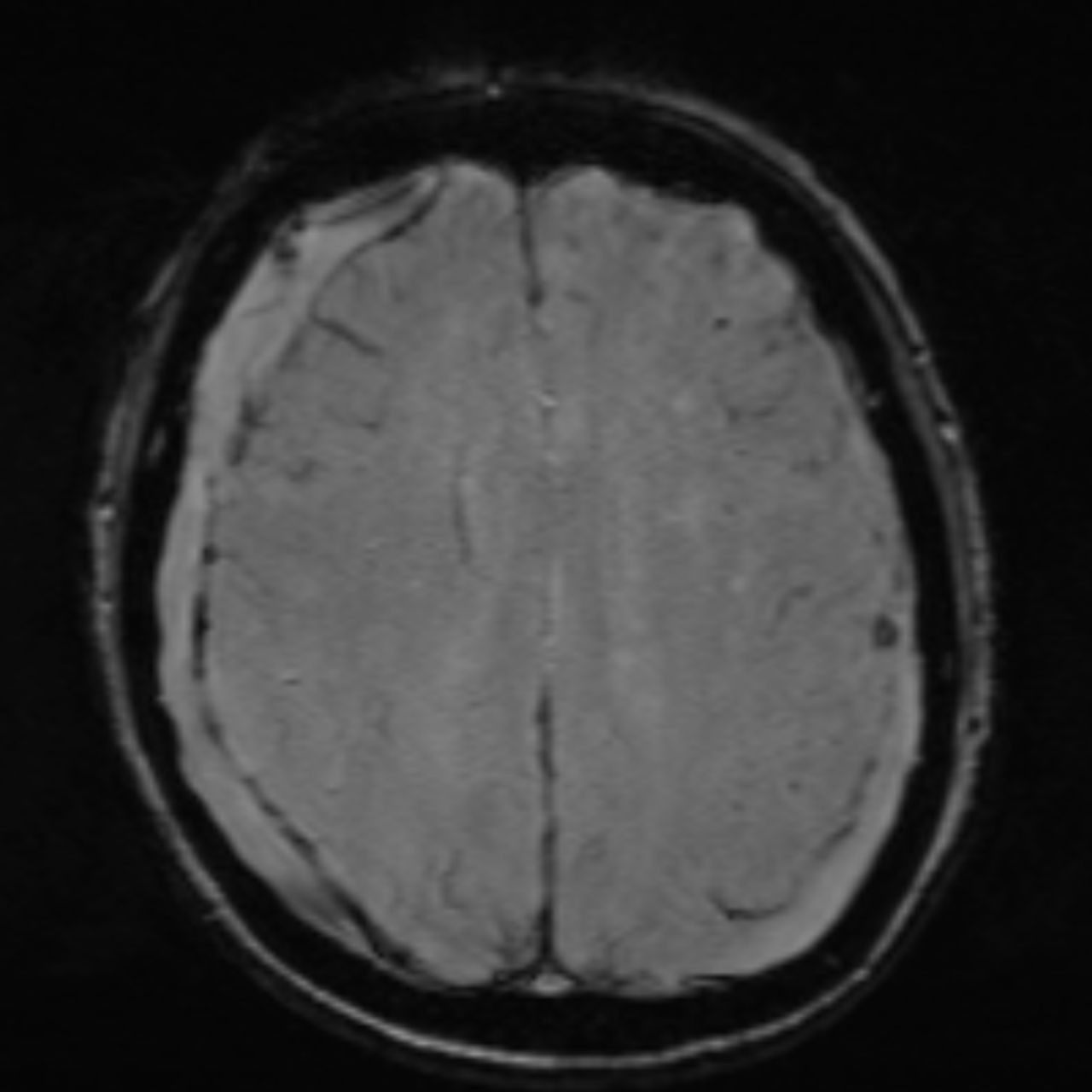 David Tafur Muñoz-2166