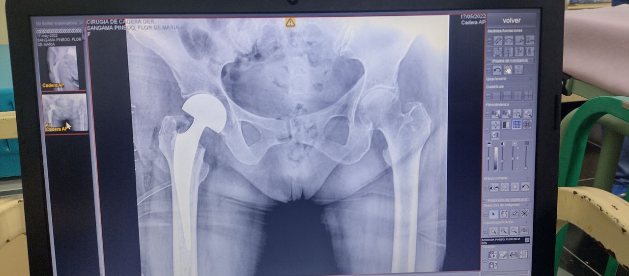 Carlos Escalante Saavedra-14