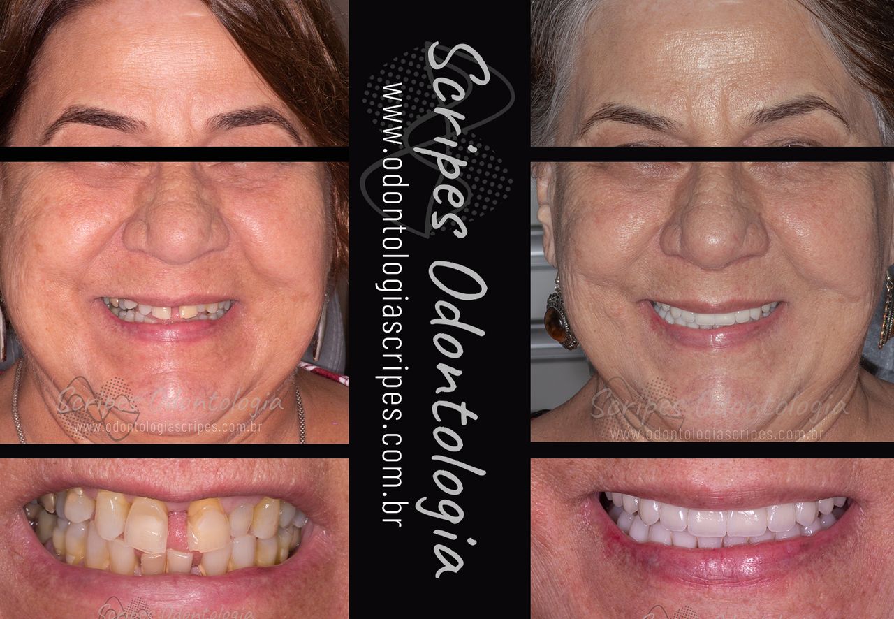 Gabriel Godoy Scripes-71