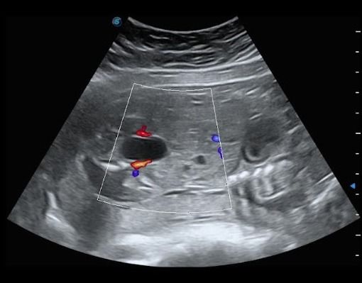 Lady Tatiana Duarte Lopez-15