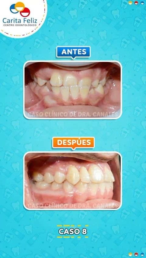 Angela Canales Larrea-3