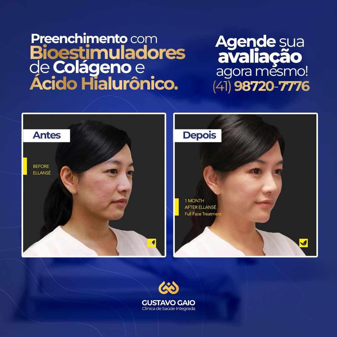 Franciele Delgado Gaio-4