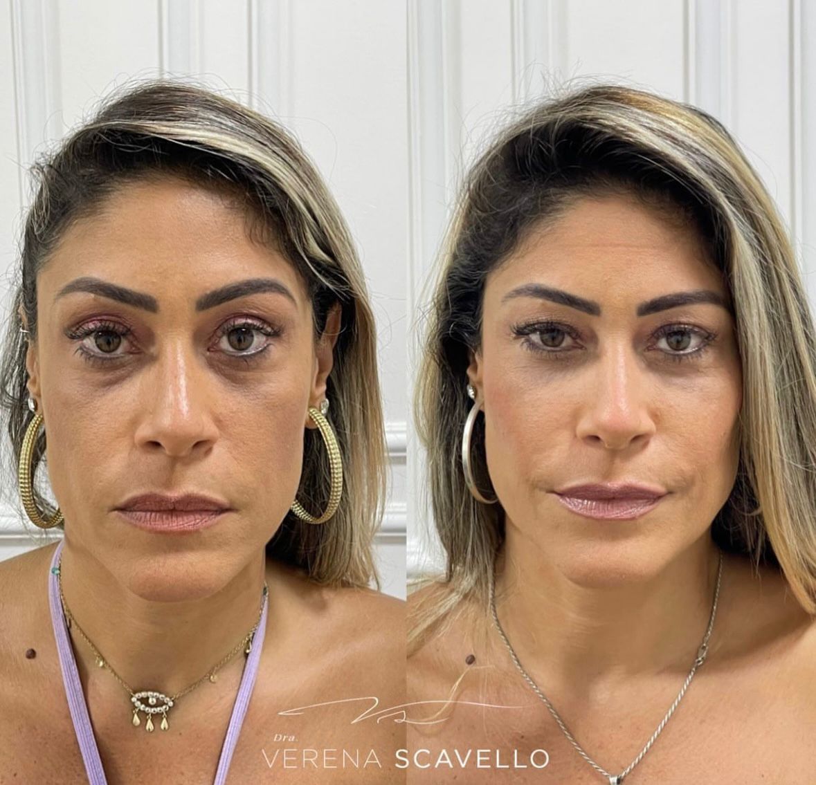 Verena Scavello-4