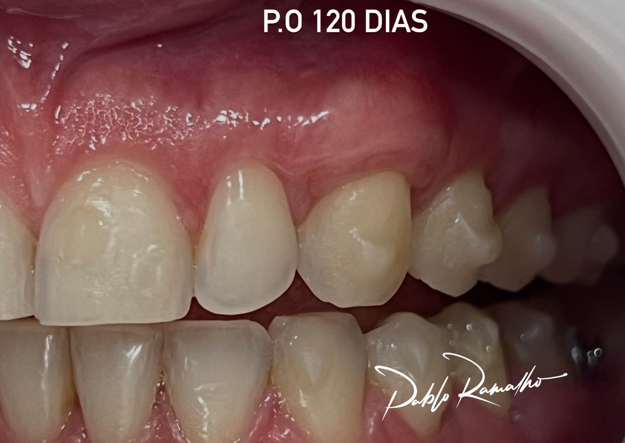 Pablo  Ramalho-18