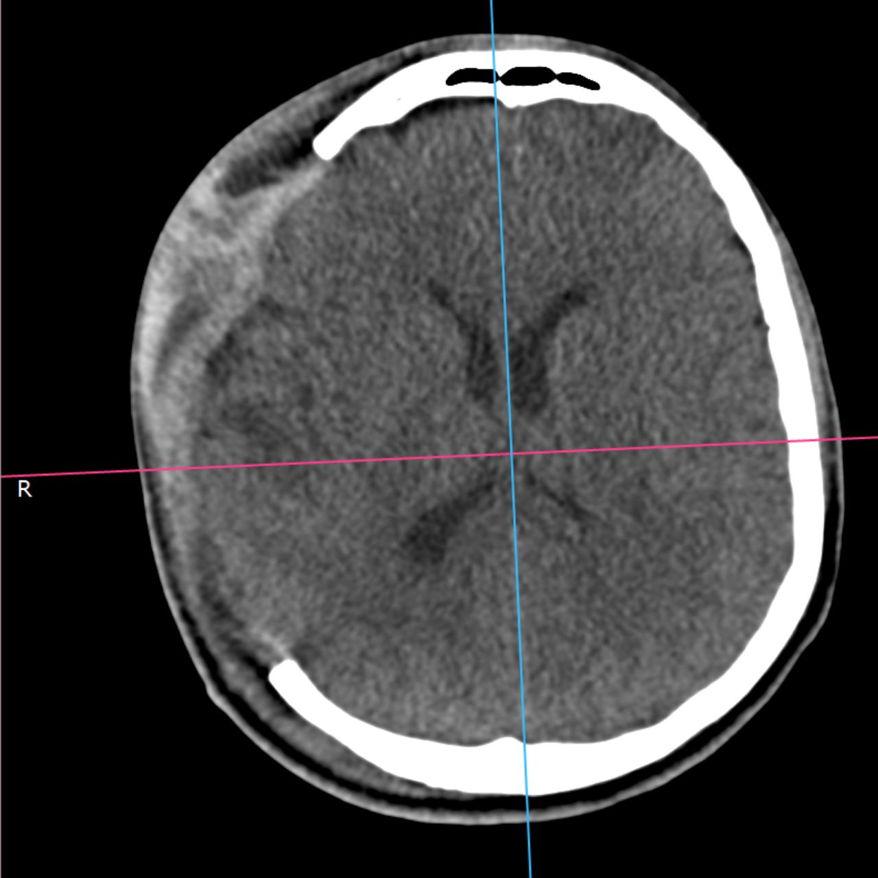 David Tafur Muñoz-1890