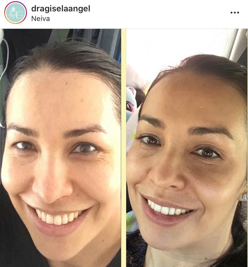 Maria Gisela Angel Losada-34