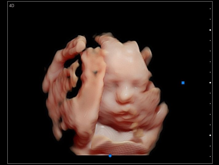 Lady Tatiana Duarte Lopez-9