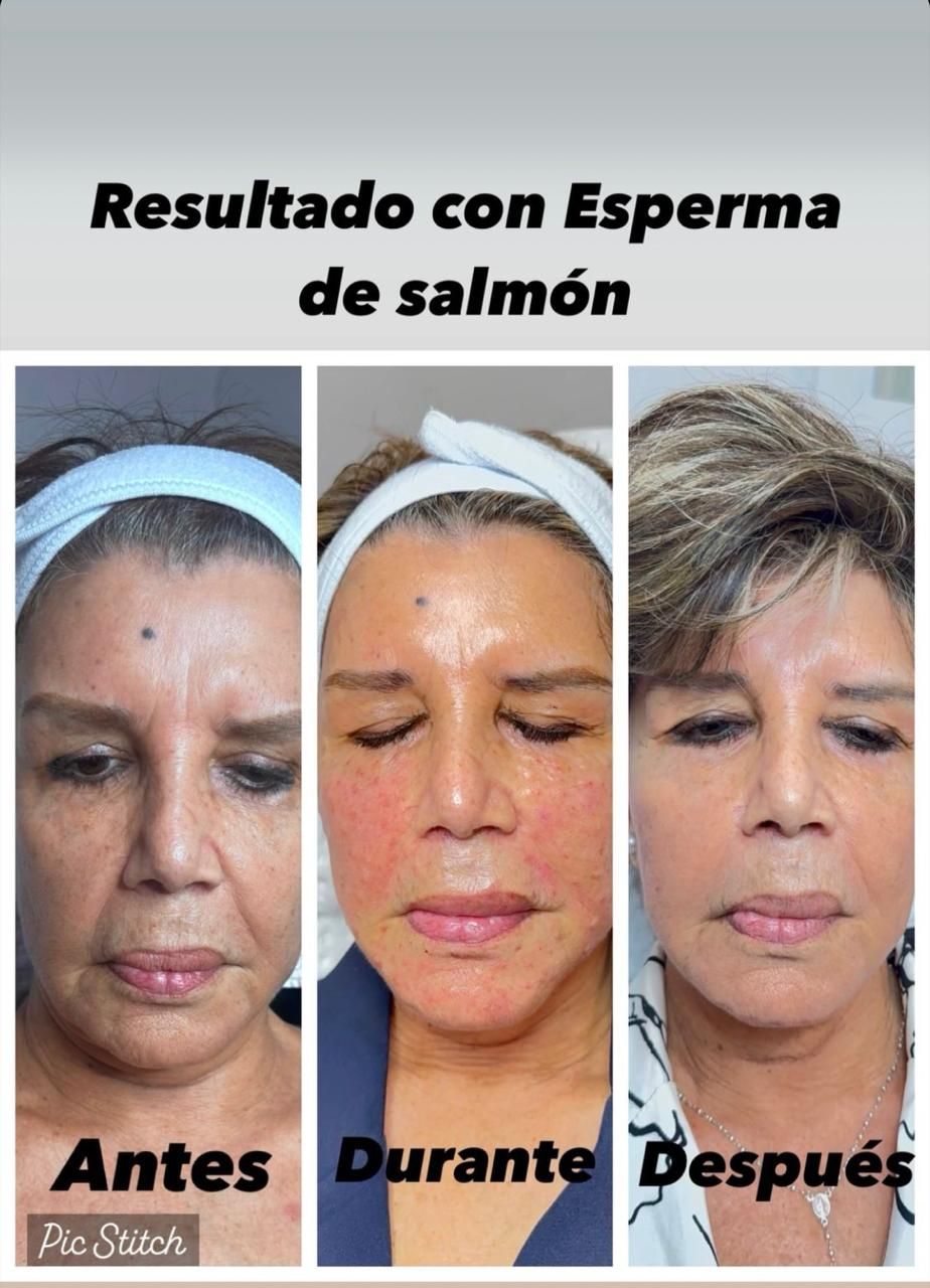 Jeison De Jesus Zuñiga Lara-15