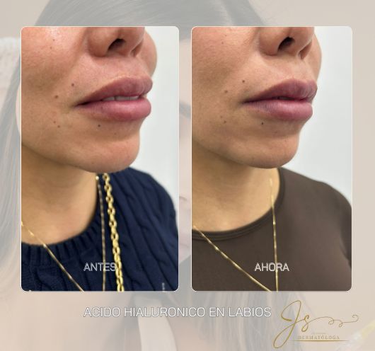 Jasiel Sarai Salas Gomez-5