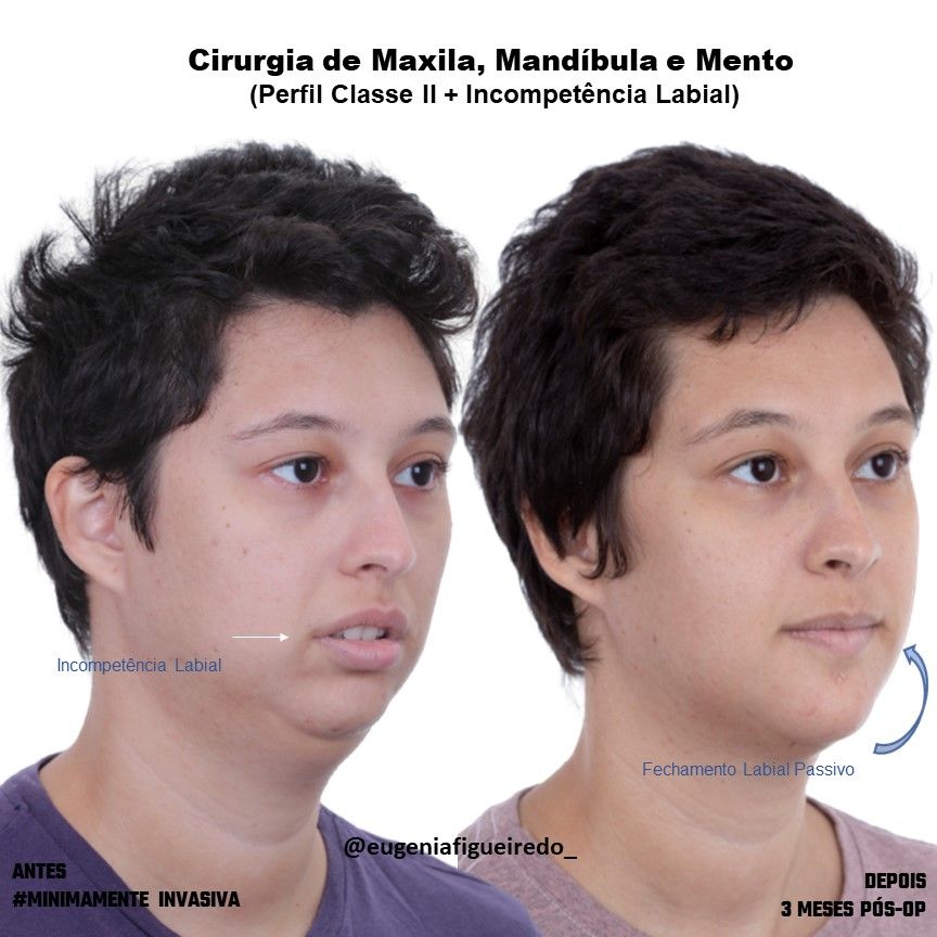 Eugênia Figueiredo-19