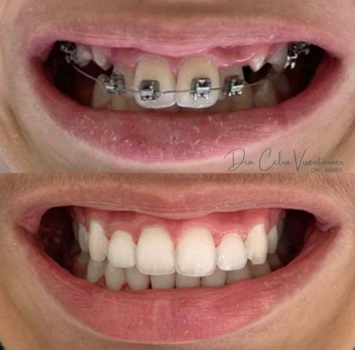 Celia Visentainer Dela Libera-1