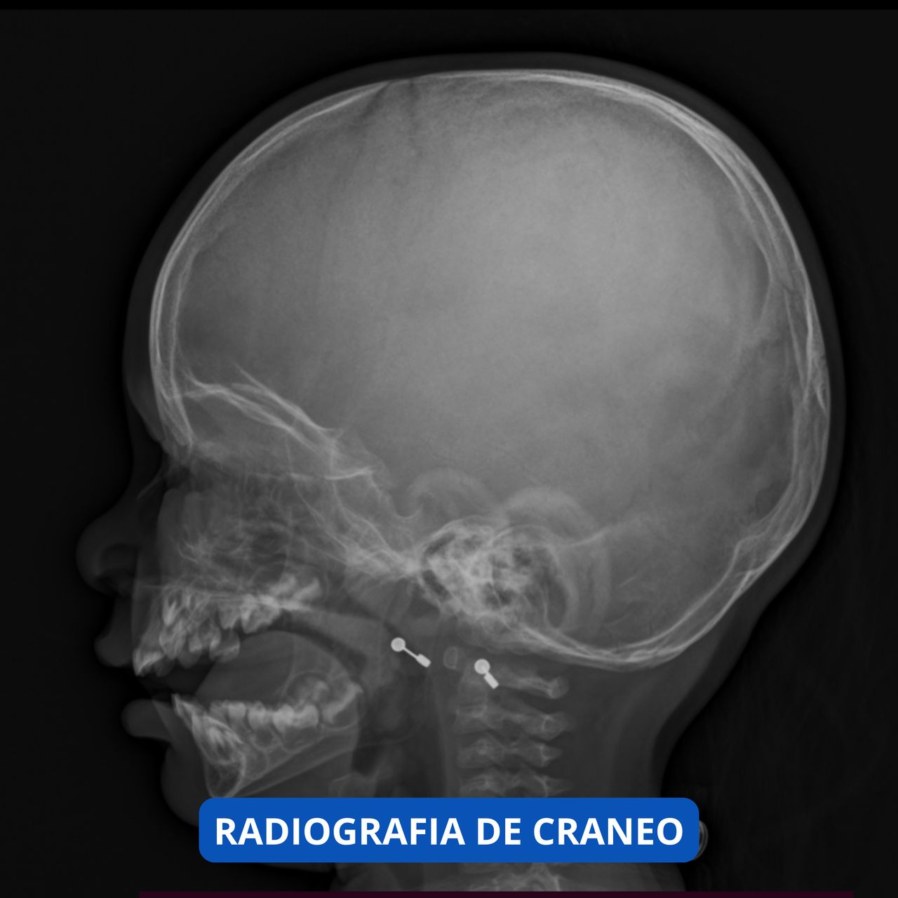 David Tafur Muñoz-1135