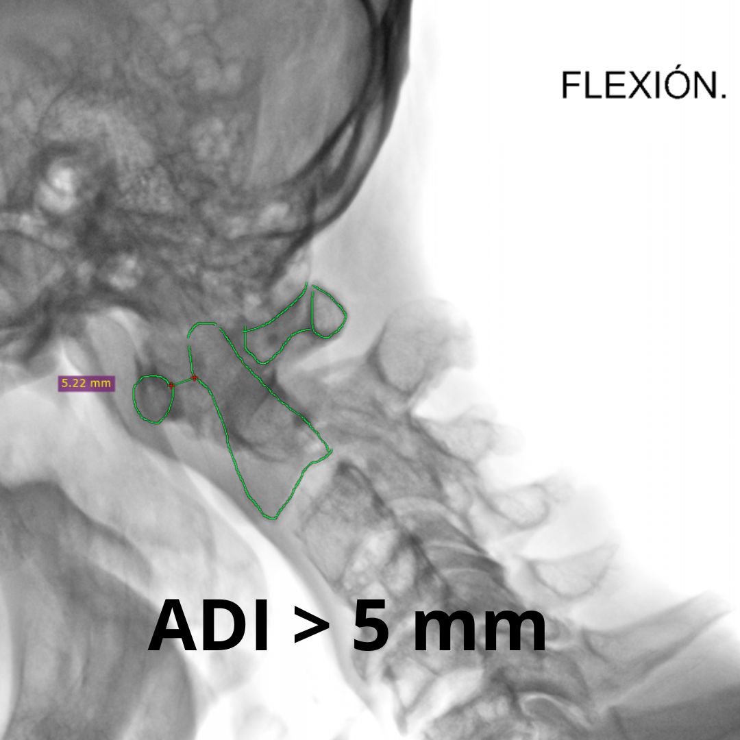 David Tafur Muñoz-2309