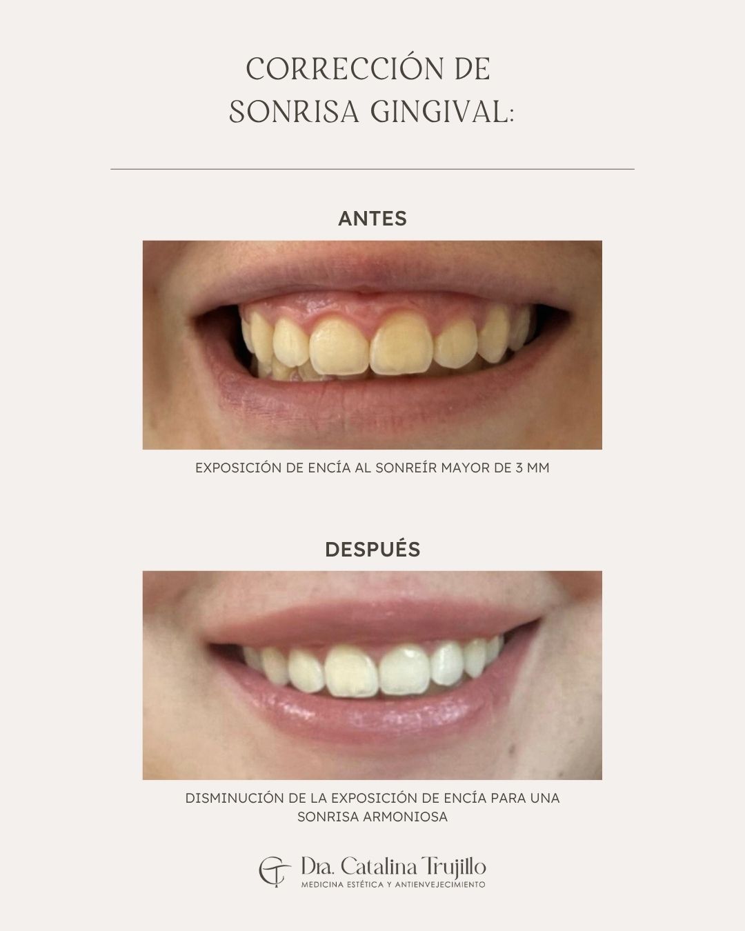 Catalina Trujillo -11