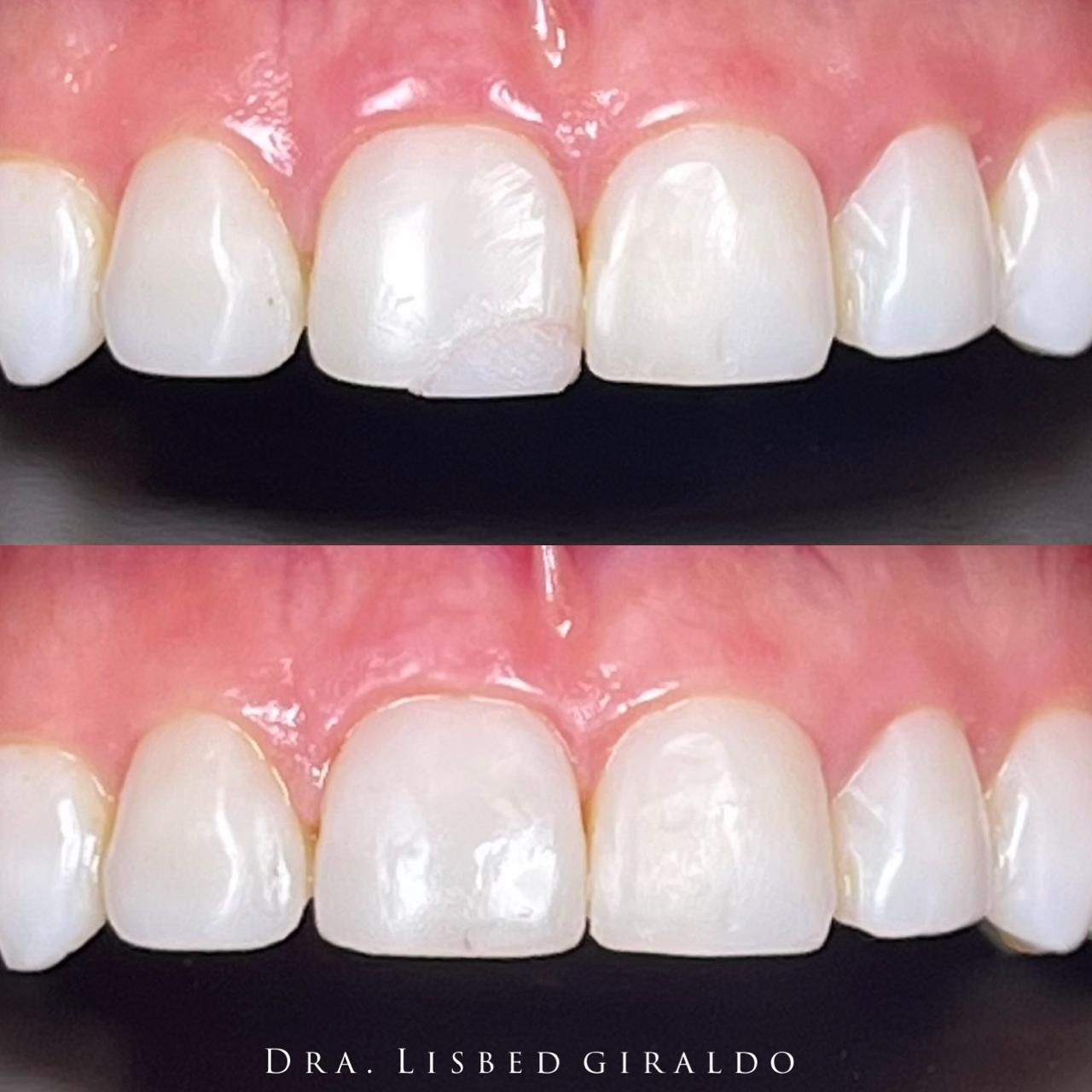 Lisbed Giraldo Olarte-23