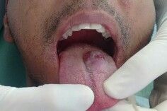 Alexandre Giannini-17