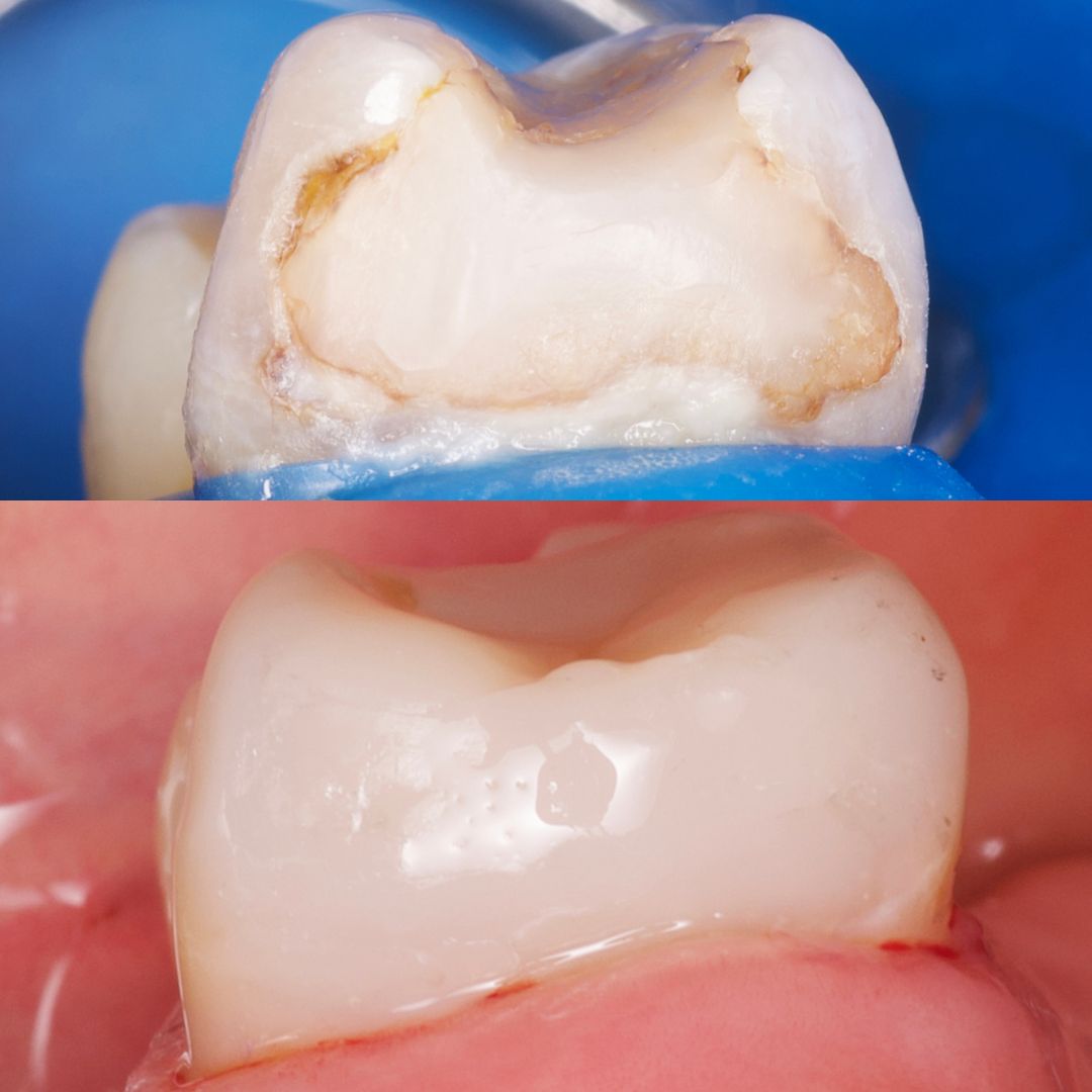 Andrés Verdugo Bolumburu-10