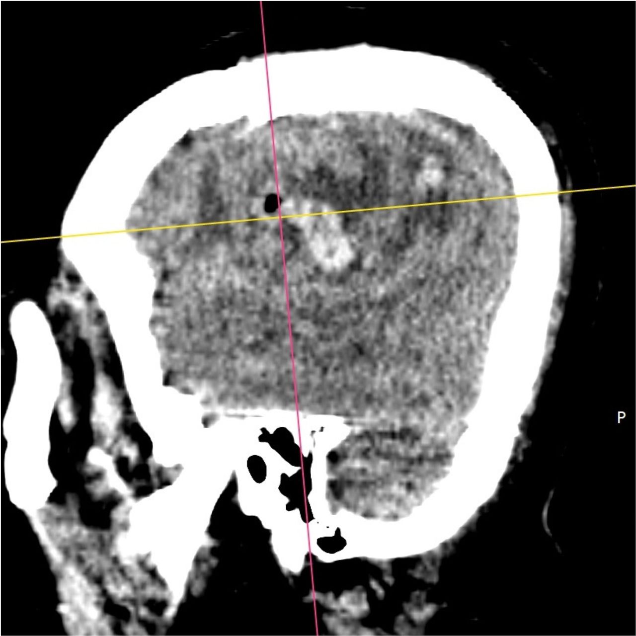 David Tafur Muñoz-1586