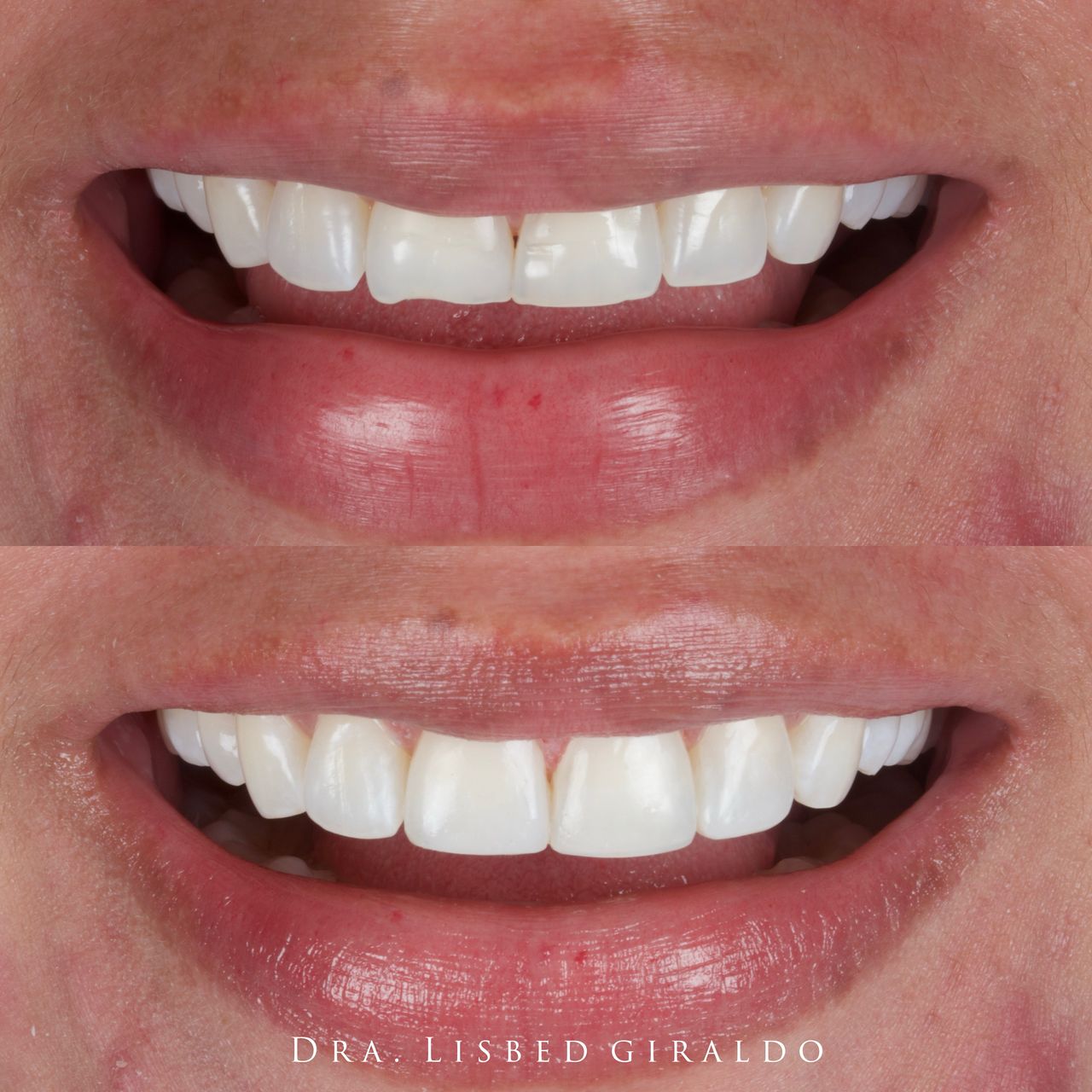 Lisbed Giraldo Olarte-8