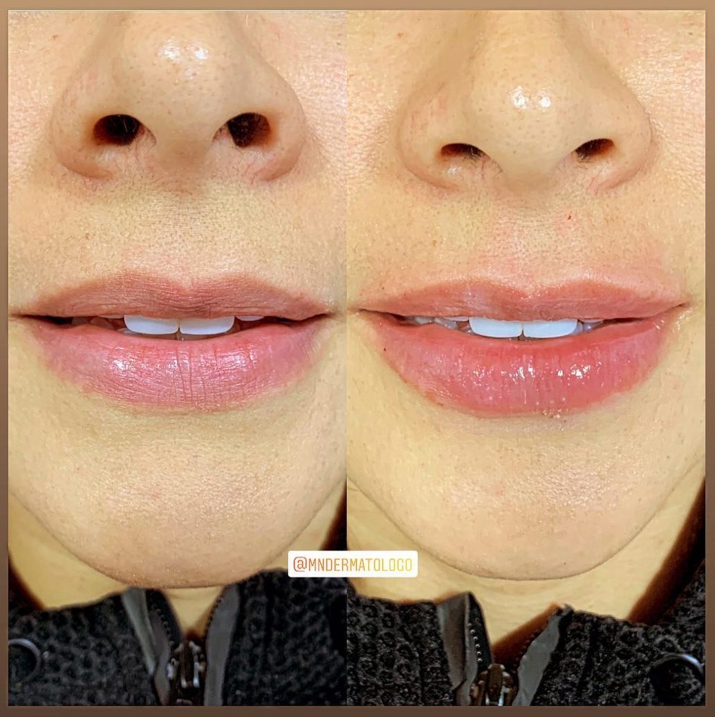 Mario Naranjo Otero-16