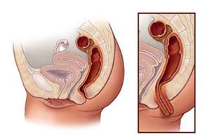Vinicius Amaro Chagas Mesquita-1
